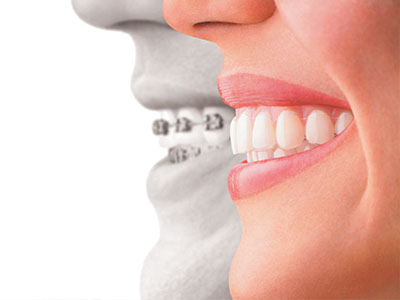 Park Street Dental Associates | Dentures, All-on-6 reg  and Oral Cancer Screening