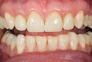 Park Street Dental Associates | Pediatric Dentistry, TMJ Disorders and Cosmetic Dentistry