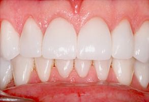 Park Street Dental Associates | TMJ Disorders, Invisalign reg  and Digital Radiography