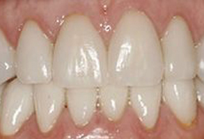 Park Street Dental Associates | Pediatric Dentistry, Preventative Program and Teeth Whitening