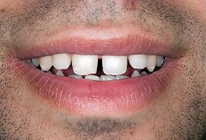 Park Street Dental Associates | All-on-6 reg , Sedation Dentistry and All-on-4 reg
