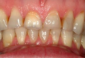 Park Street Dental Associates | Teeth Whitening, All-on-4 reg  and Pediatric Dentistry