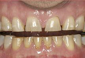 Park Street Dental Associates | Dental Cleanings, Pediatric Dentistry and Oral Cancer Screening