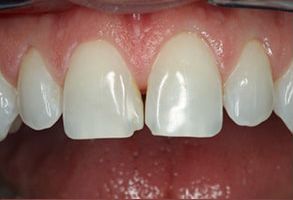 Park Street Dental Associates | Invisalign reg , Cosmetic Dentistry and Oral Exams